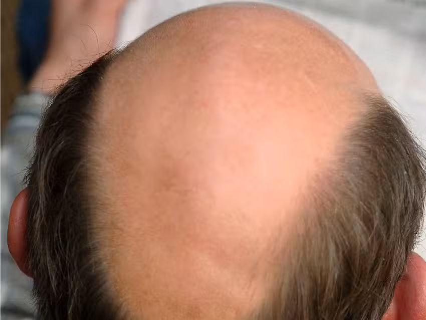 Hair Impression