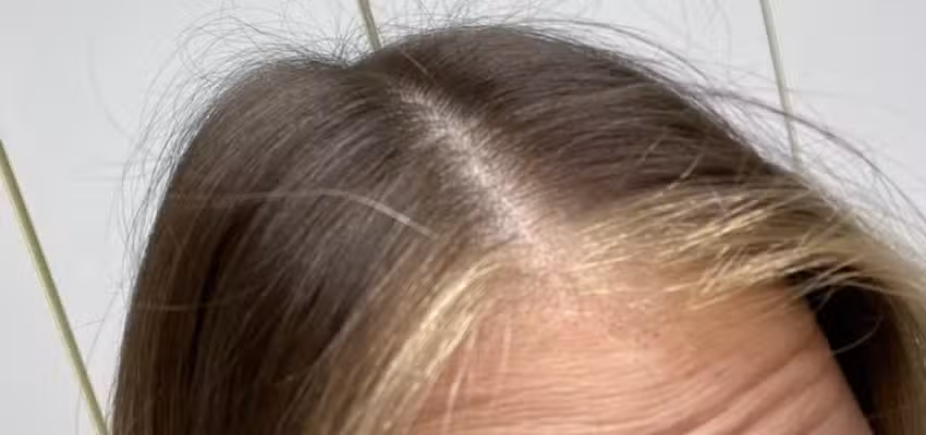 Hairmaxx